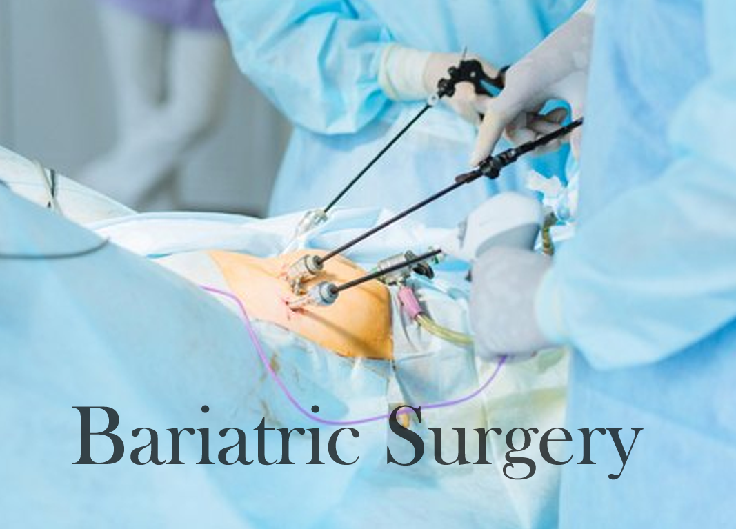 Bariatric- Surgery